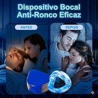 Protetor Bucal AntiRonco SleepFit™ – COMPRE 1 LEVE 2
